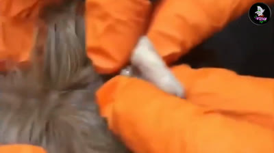 Deleita tus ojos con la hipnotizante extracción de espinillas en cámara lenta, capturando cada detalle de este proceso fascinante. 